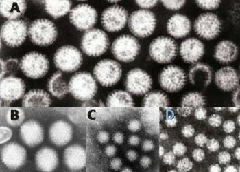 Penyakit refluks pada anak