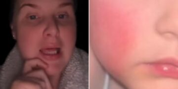 Daycare Horror: Mom’s Fury Over Daughter’s Terrifying Transformation