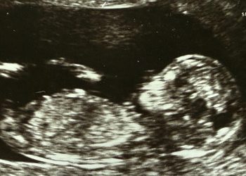 IVF Leader Back in the Game as New Bid Boosts Shares